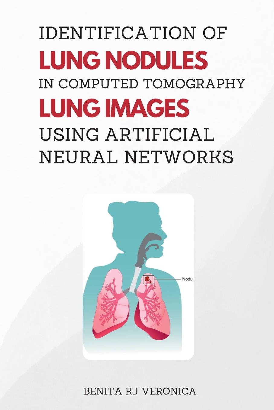 Vorderes Coverbild Identification of Lung Nodules in Computed Tomography Lung Images Using Artificial Neural Networks