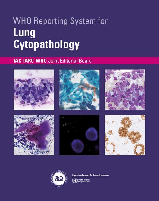 Vorderes Coverbild Who Reporting System for Lung Cytopathology