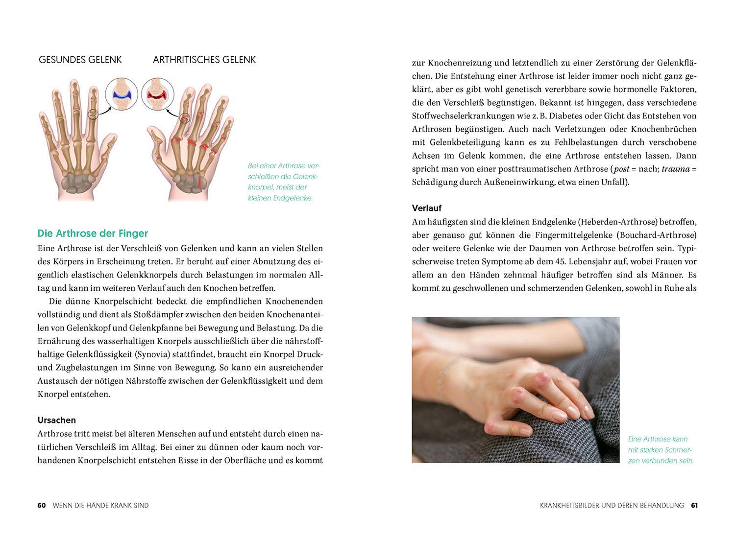 Beispielinhalt (Bild) Gesunde und starke Hände