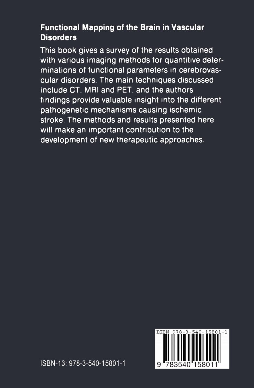 Rückseitencover Functional Mapping of the Brain in Vascular Disorders