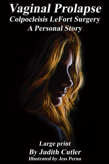 Vorderes Coverbild Vaginal Prolapse Colpocleisis Lefort Surgery: A Personal Story
