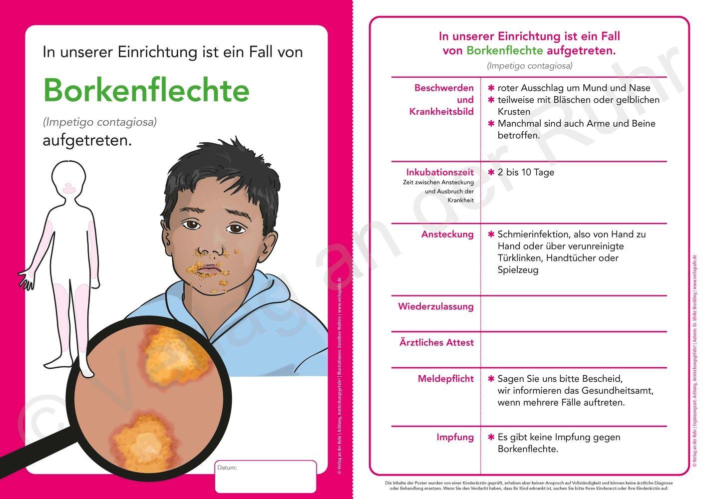 Beispielinhalt (Bild) Ergänzungsset: Achtung, Ansteckungsgefahr! - 8 weitere Aushänge und Merkblätter zu übertragbaren Krankheiten