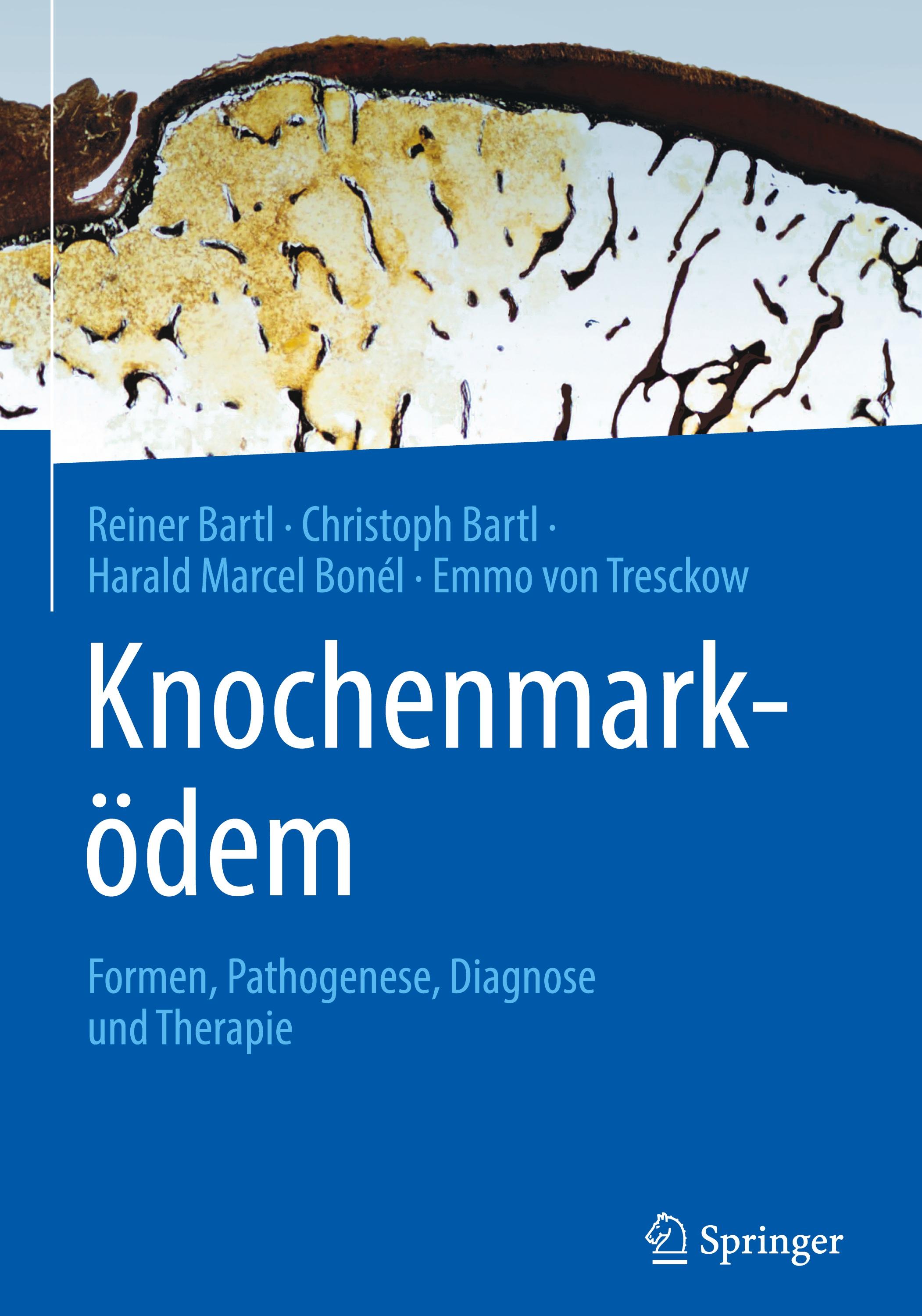 Vorderes Coverbild Knochenmarködem