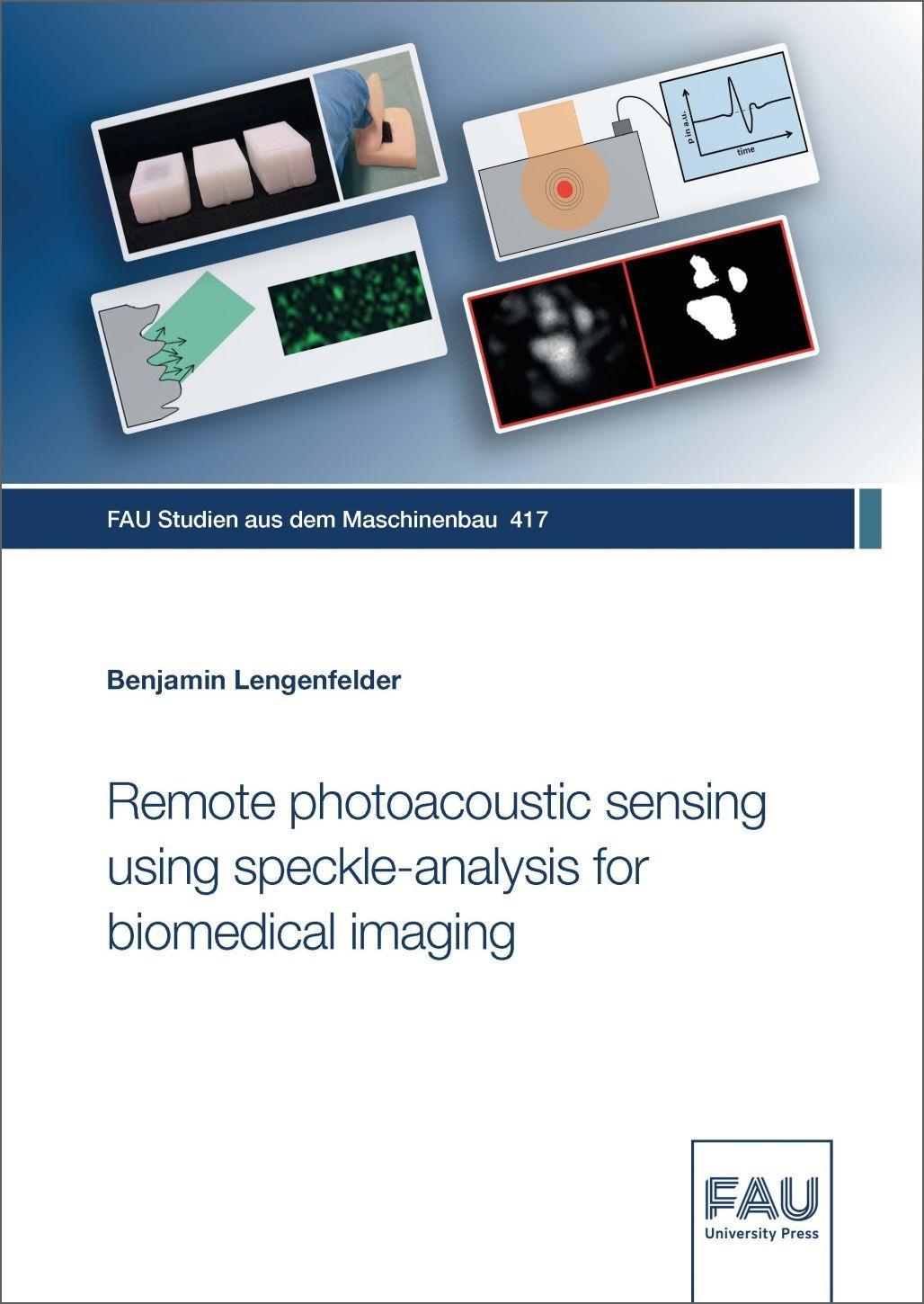 Vorderes Coverbild Remote photoacoustic sensing using speckle-analysis for biomedical imaging