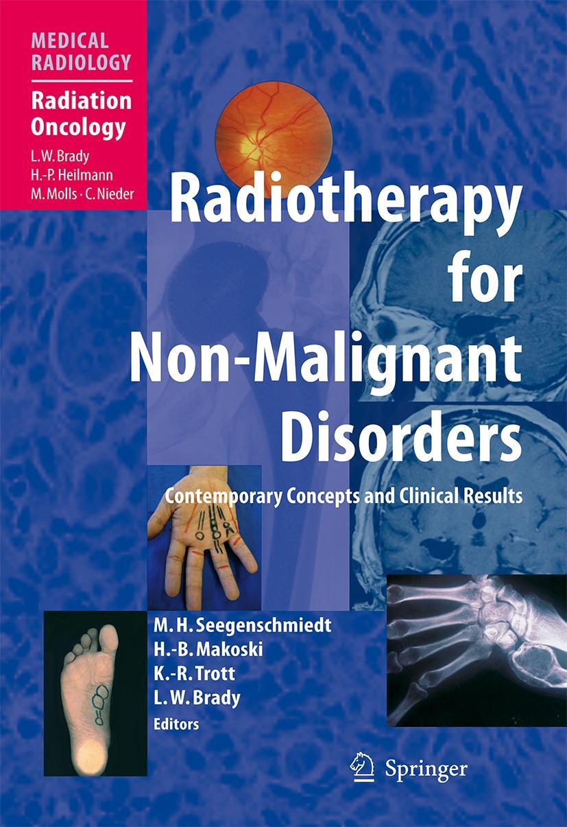 Vorderes Coverbild Radiotherapy for Non-Malignant Disorders