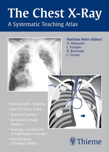 Vorderes Coverbild Chest X-ray Trainer