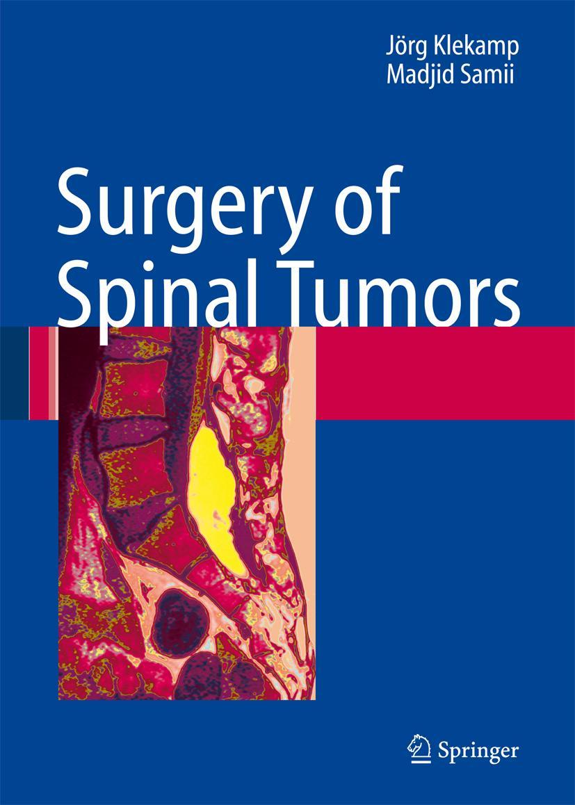 Vorderes Coverbild Surgery of Spinal Tumors