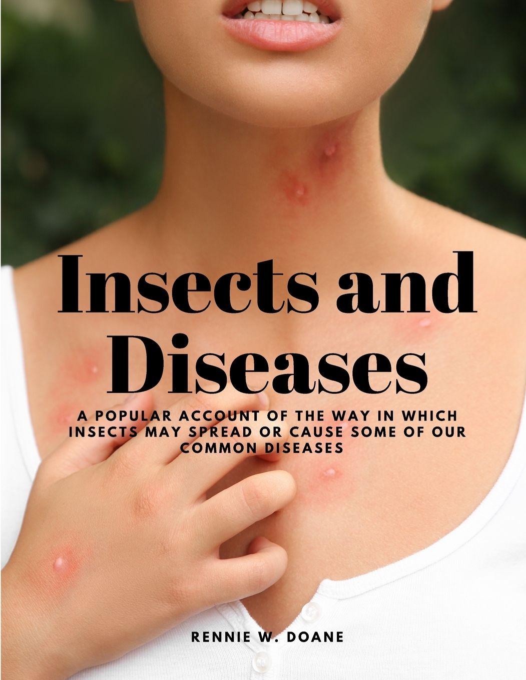 Vorderes Coverbild Insects and Diseases - A Popular Account of the Way in Which Insects may Spread or Cause some of our Common Diseases