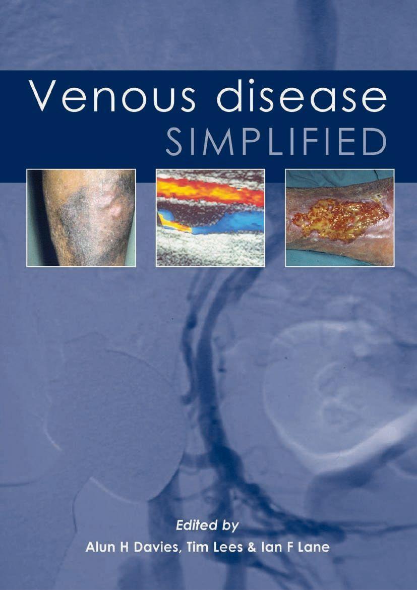 Vorderes Coverbild Venous Disease Simplified