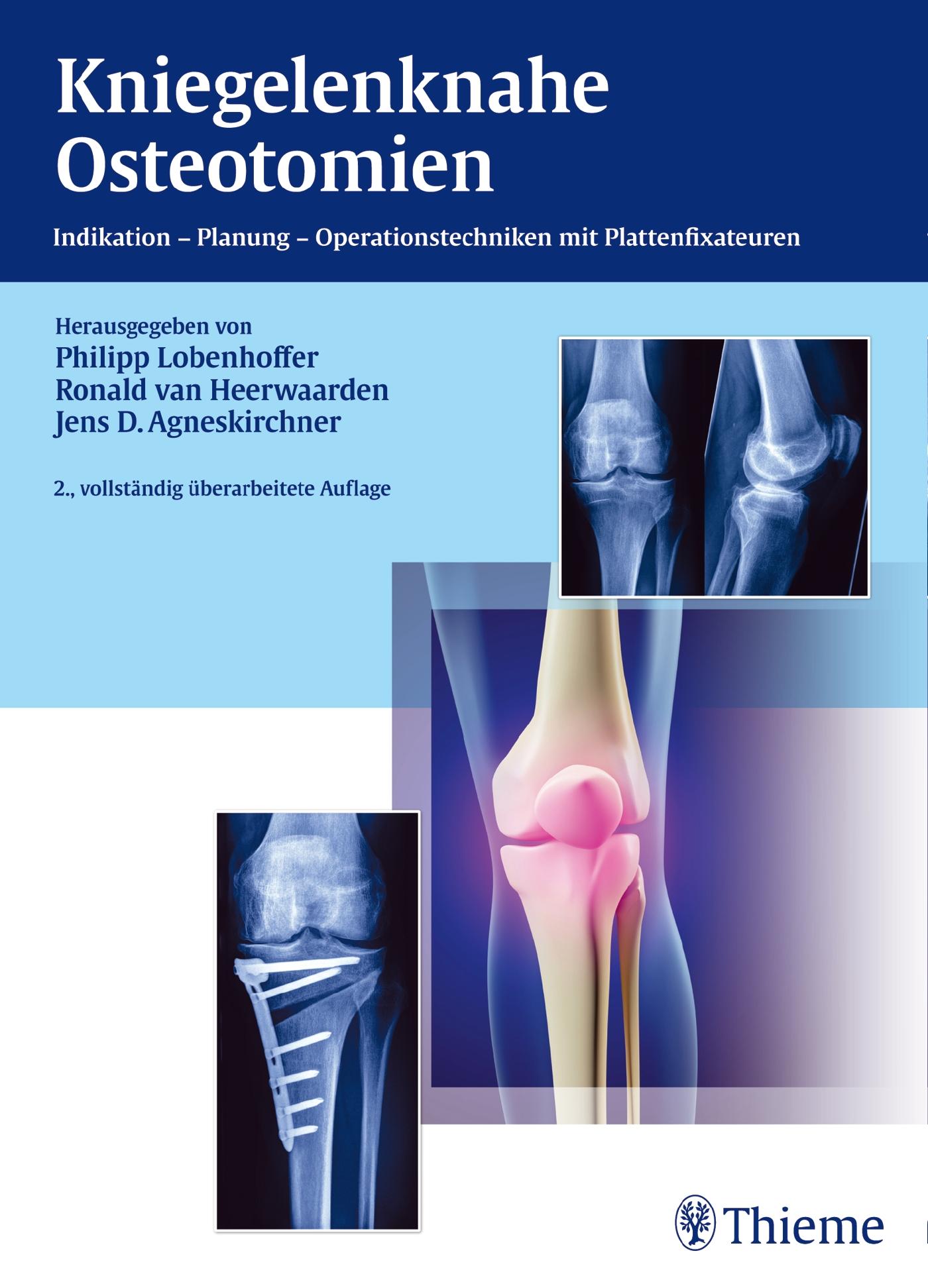 Vorderes Coverbild Kniegelenknahe Osteotomien