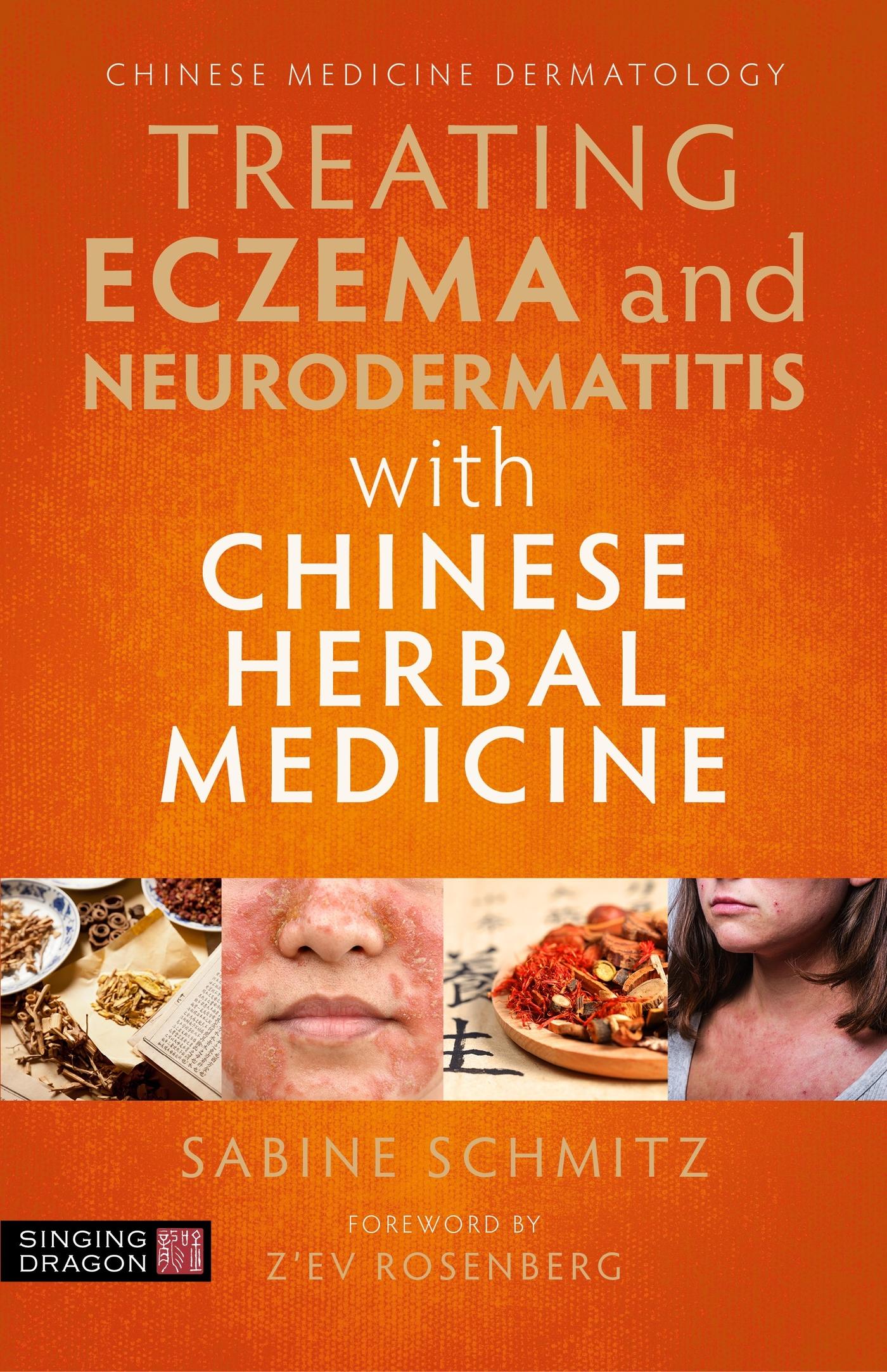 Vorderes Coverbild Treating Eczema and Neurodermatitis with Chinese Herbal Medicine