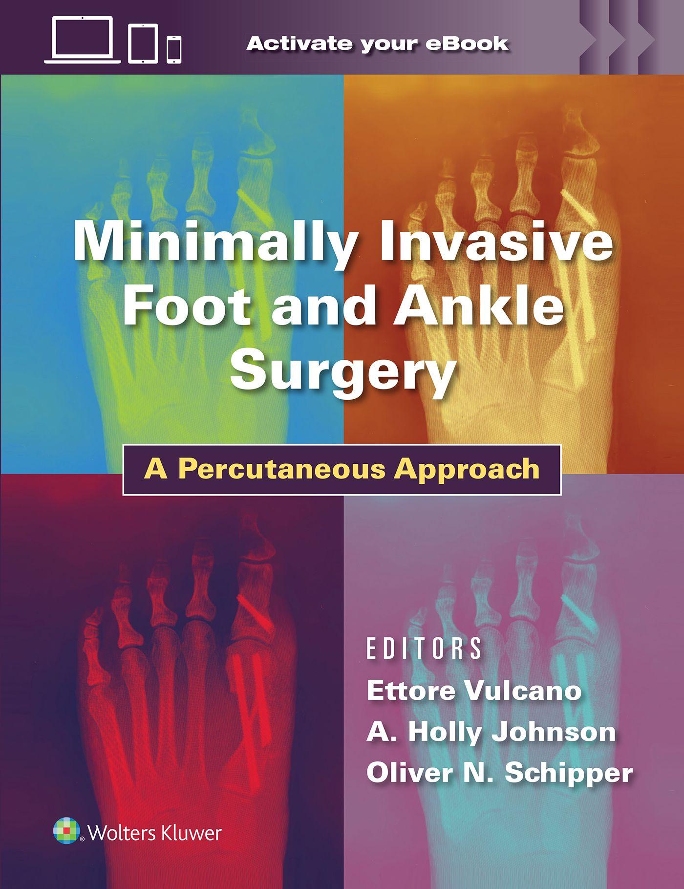 Vorderes Coverbild Minimally Invasive Foot and Ankle Surgery