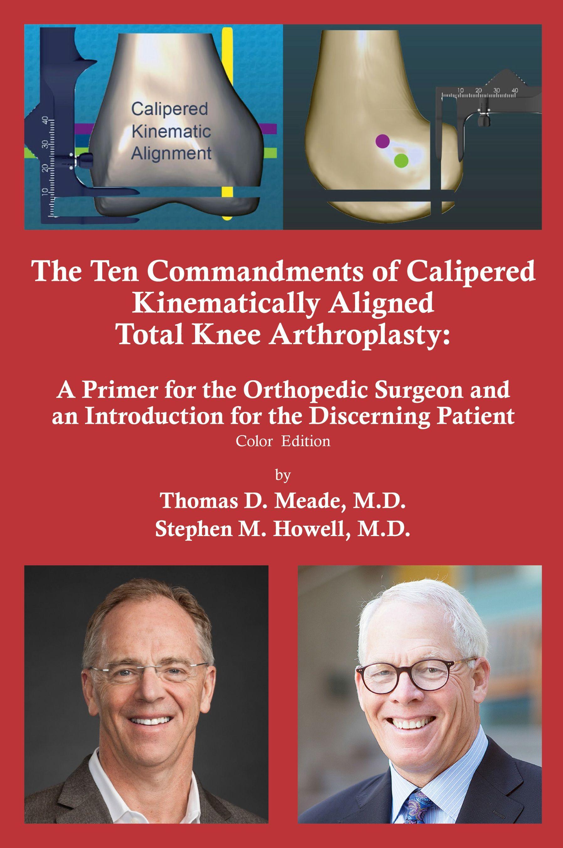 Vorderes Coverbild The Ten Commandments of Calipered Kinematically Aligned Total Knee Arthroplasty