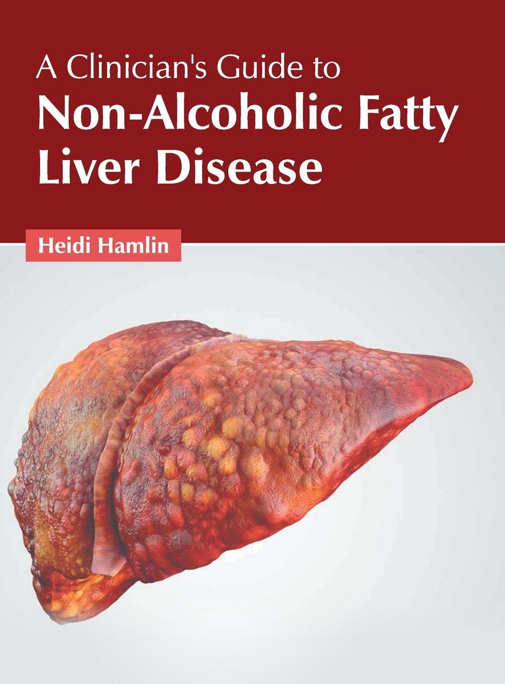 Vorderes Coverbild A Clinician's Guide to Non-Alcoholic Fatty Liver Disease