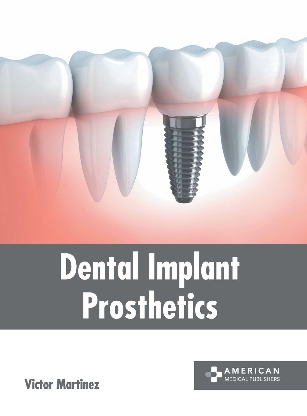 Vorderes Coverbild Dental Implant Prosthetics