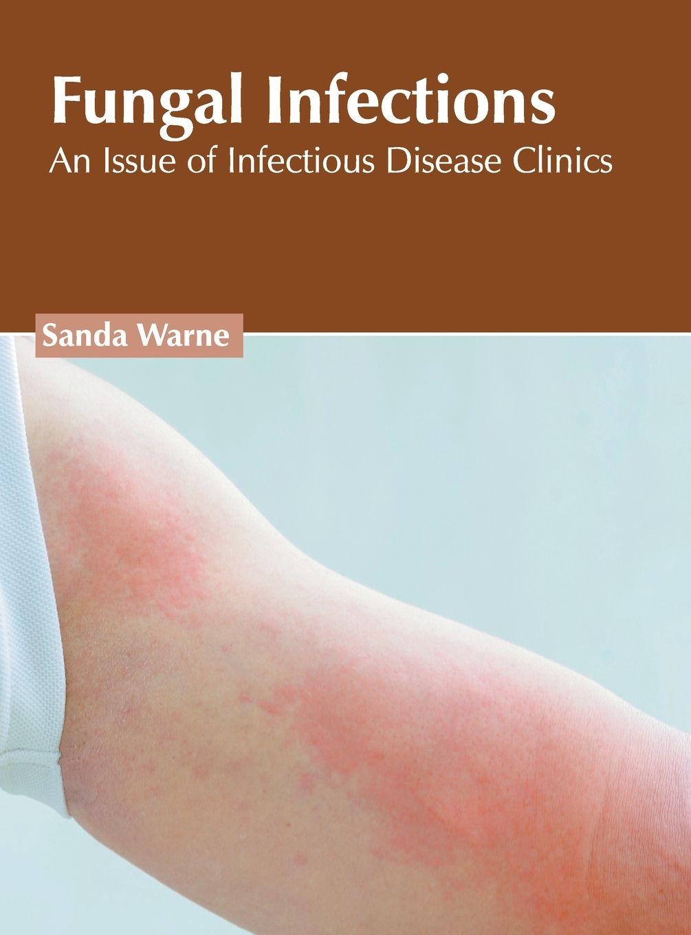 Vorderes Coverbild Fungal Infections: An Issue of Infectious Disease Clinics