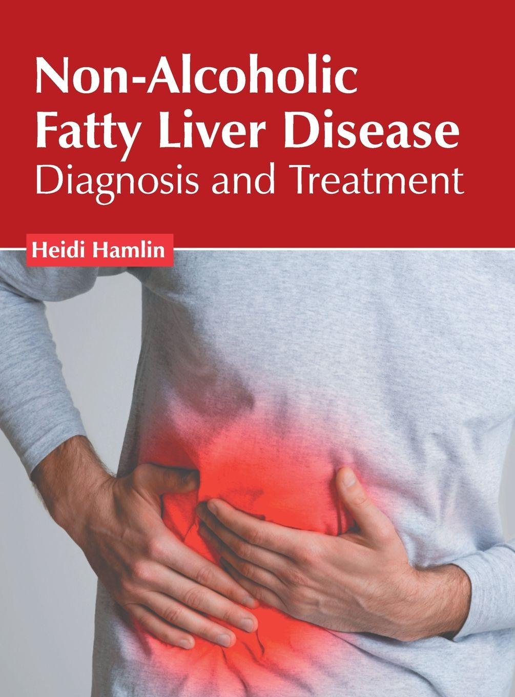 Vorderes Coverbild Non-Alcoholic Fatty Liver Disease