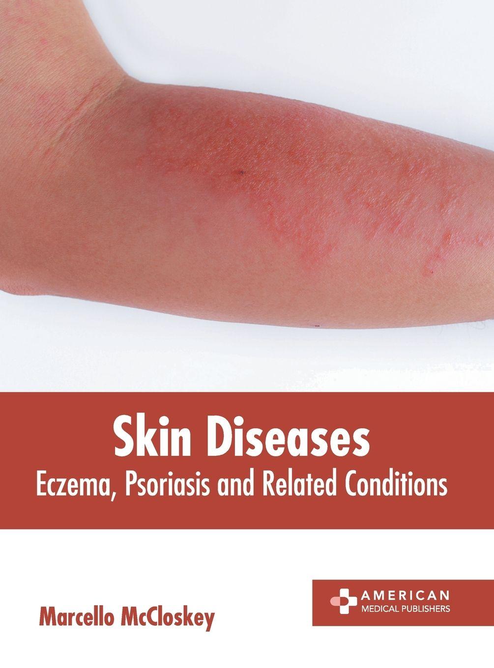 Vorderes Coverbild Skin Diseases: Eczema, Psoriasis and Related Conditions