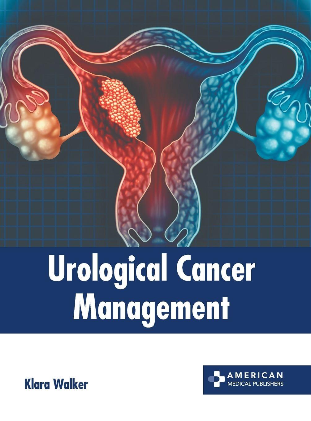 Vorderes Coverbild Urological Cancer Management