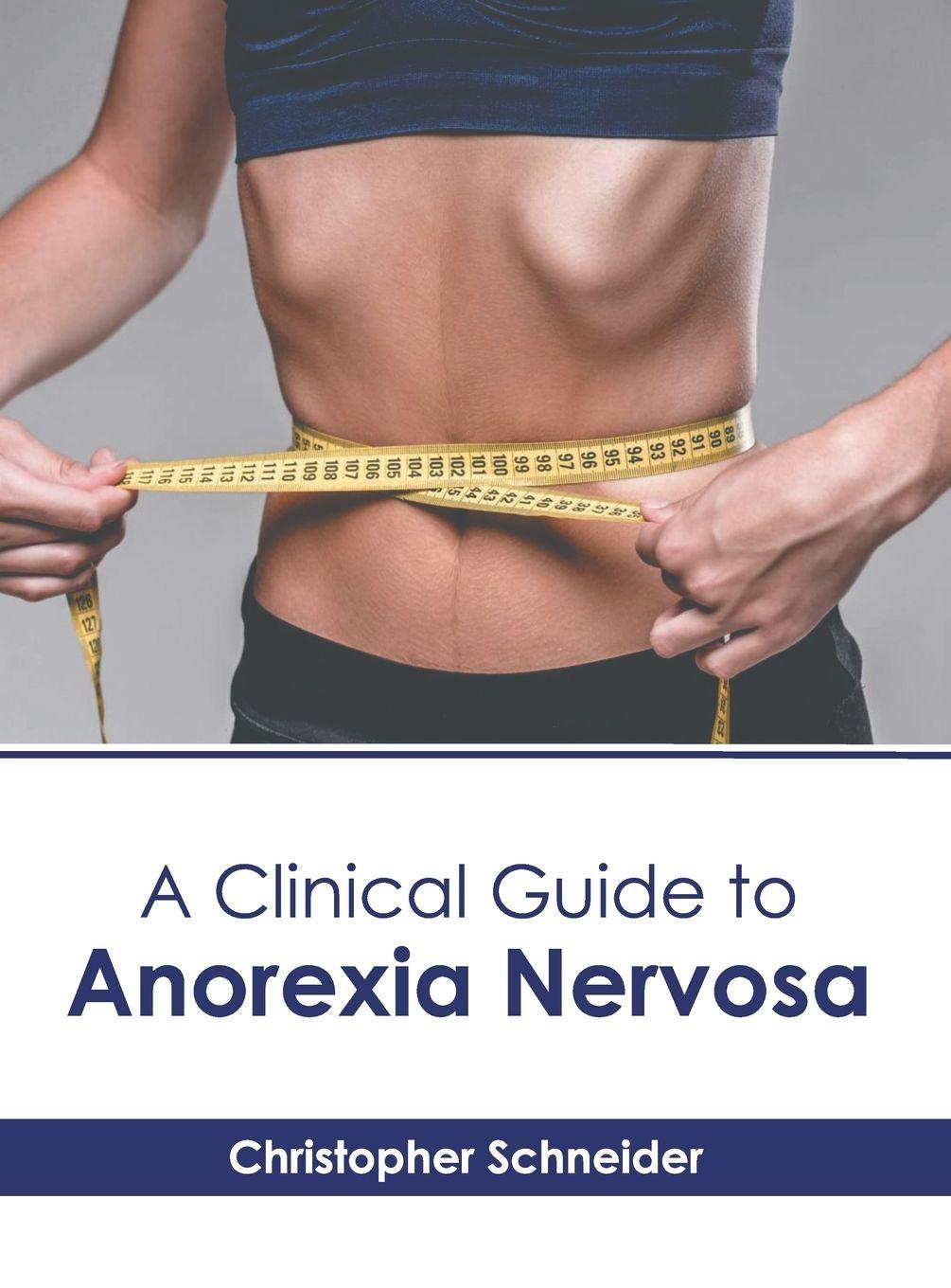 Vorderes Coverbild A Clinical Guide to Anorexia Nervosa