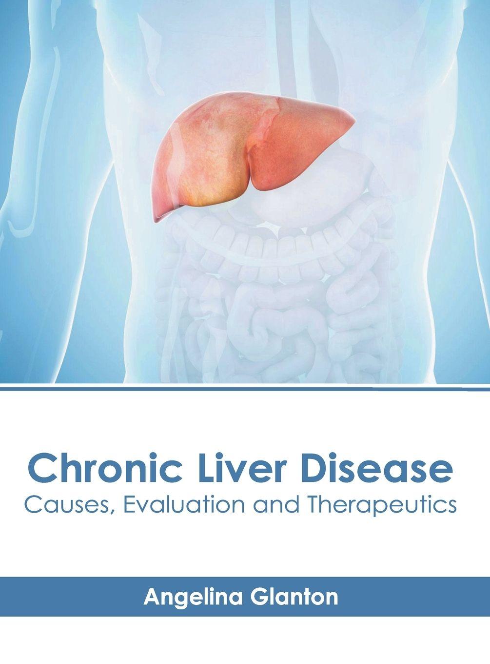 Vorderes Coverbild Chronic Liver Disease: Causes, Evaluation and Therapeutics