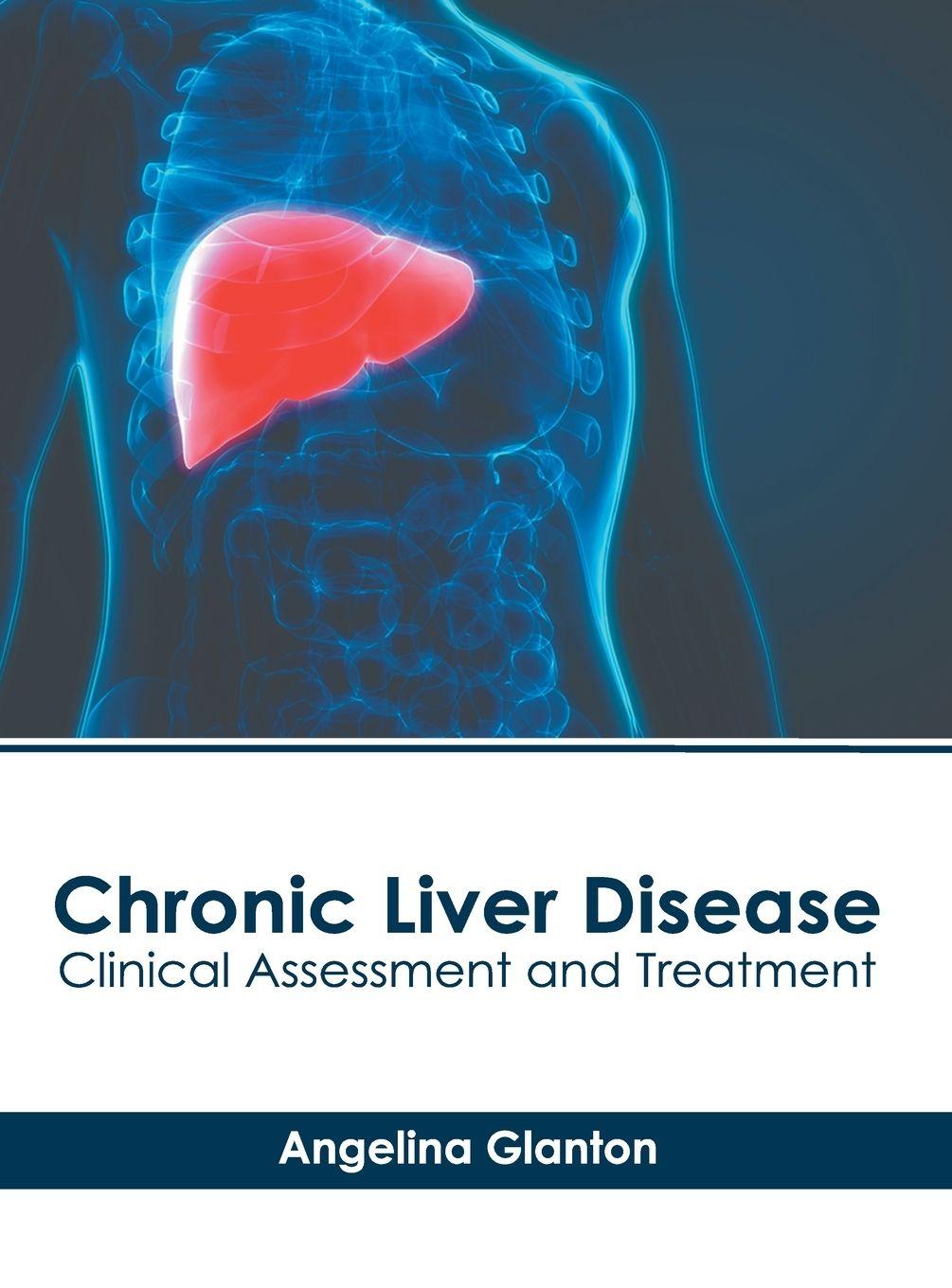 Vorderes Coverbild Chronic Liver Disease: Clinical Assessment and Treatment