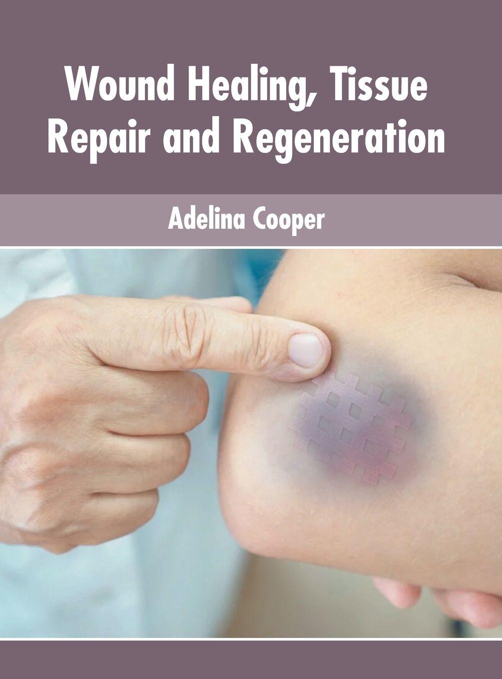 Vorderes Coverbild Wound Healing, Tissue Repair and Regeneration
