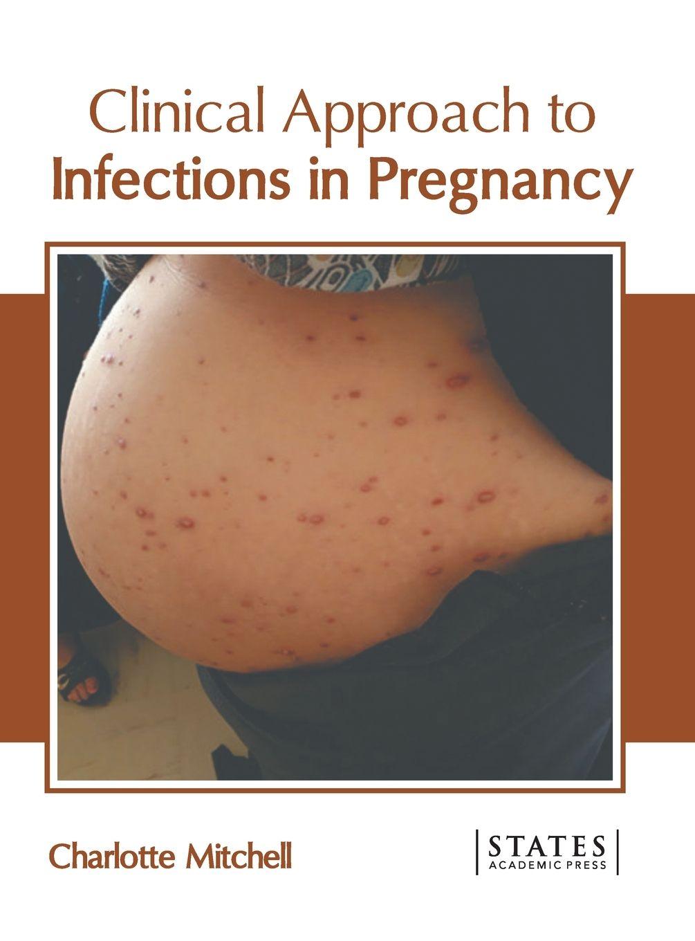 Vorderes Coverbild Clinical Approach to Infections in Pregnancy