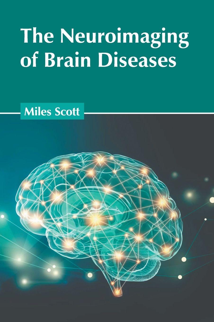Vorderes Coverbild The Neuroimaging of Brain Diseases