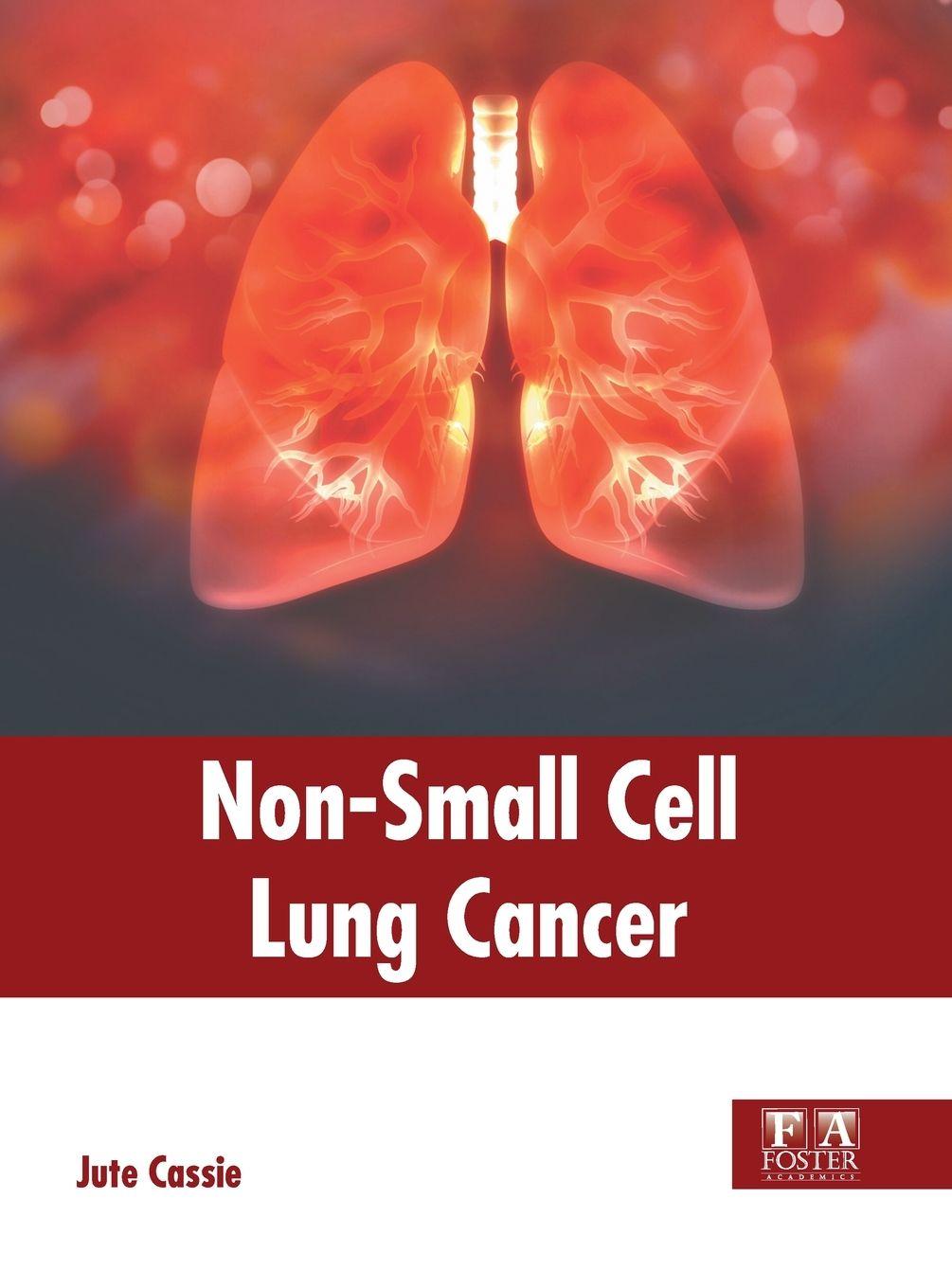 Vorderes Coverbild Non-Small Cell Lung Cancer