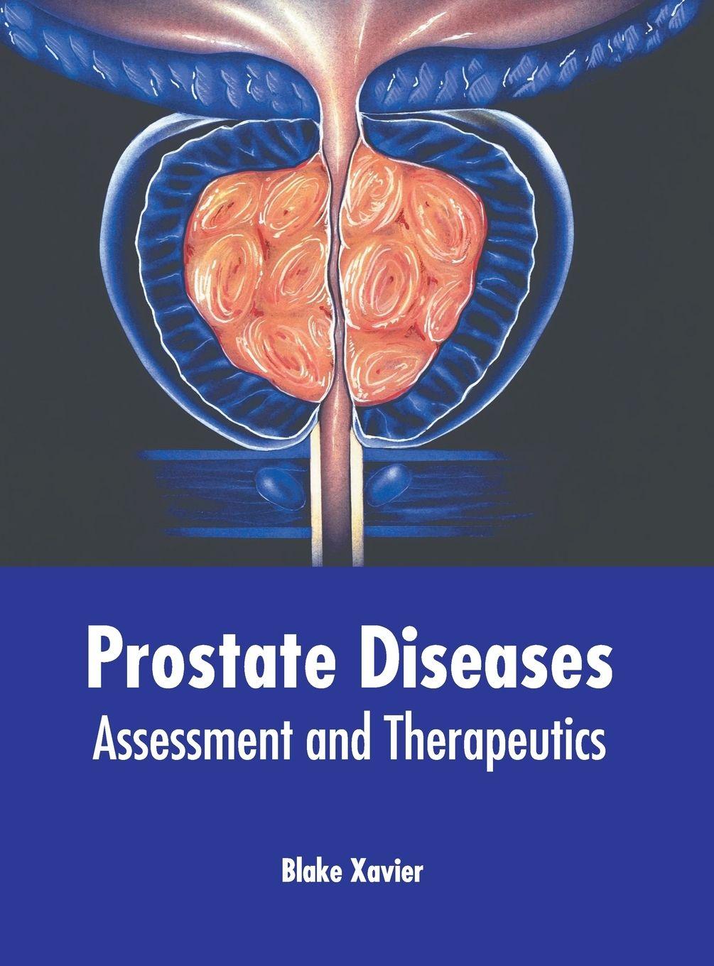 Vorderes Coverbild Prostate Diseases: Assessment and Therapeutics