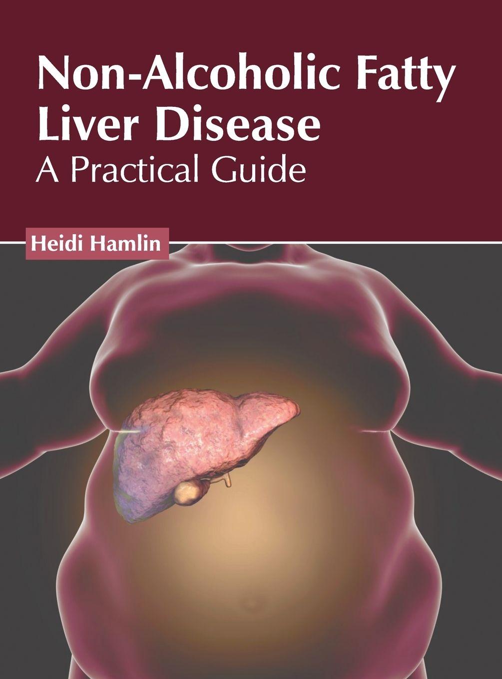 Vorderes Coverbild Non-Alcoholic Fatty Liver Disease: A Practical Guide