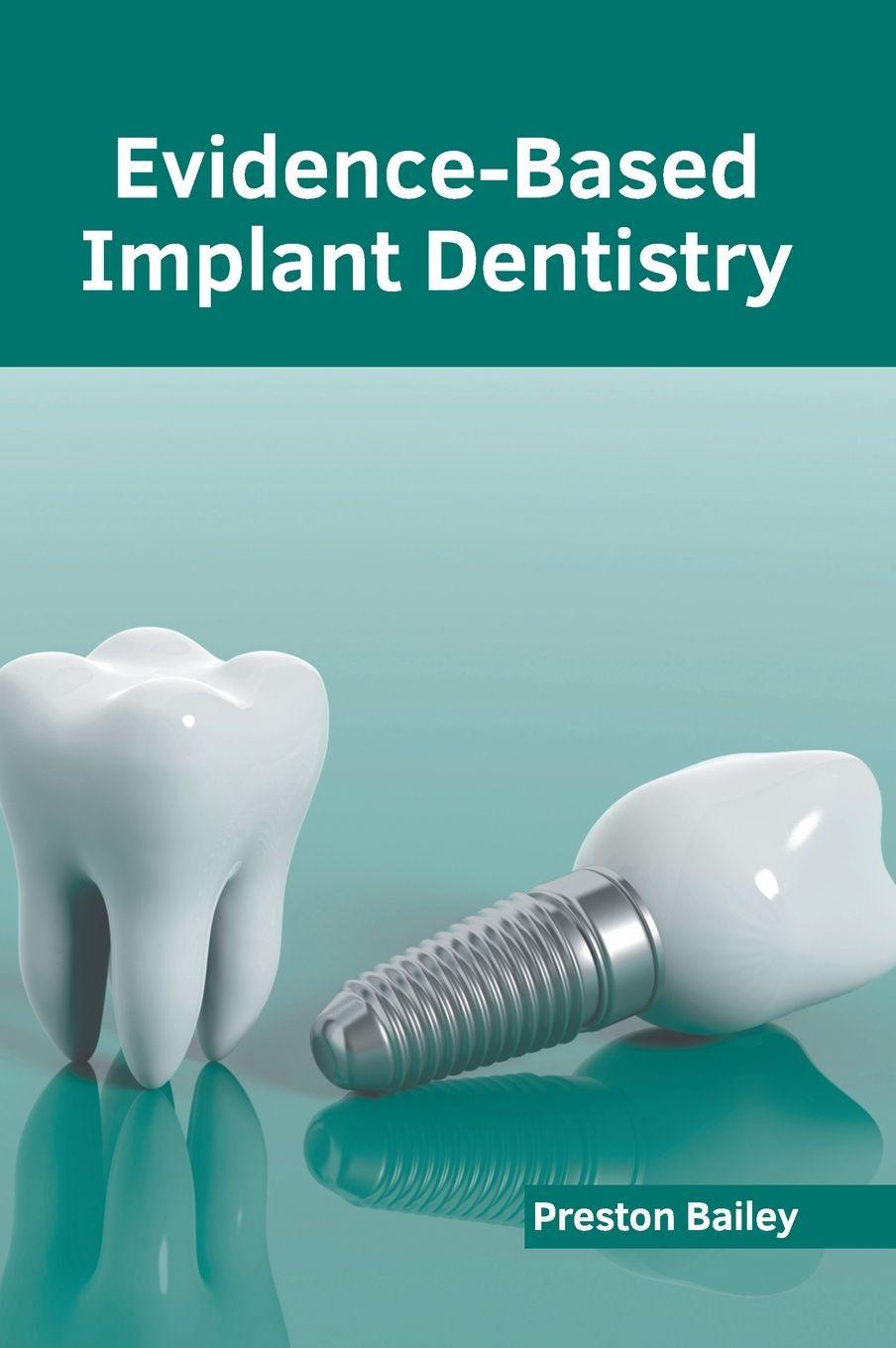 Vorderes Coverbild Evidence-Based Implant Dentistry