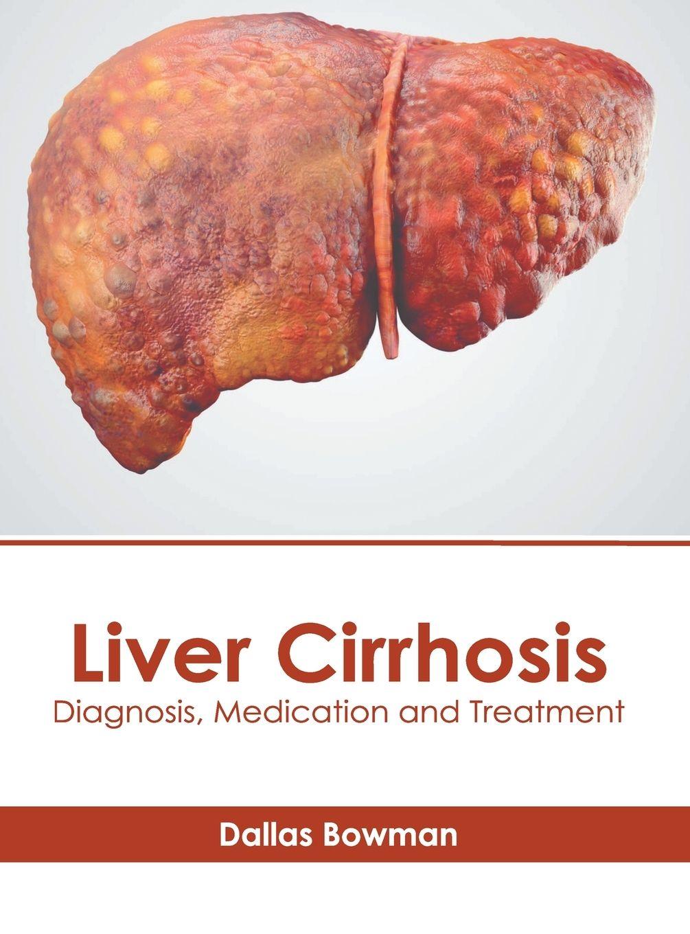 Vorderes Coverbild Liver Cirrhosis: Diagnosis, Medication and Treatment