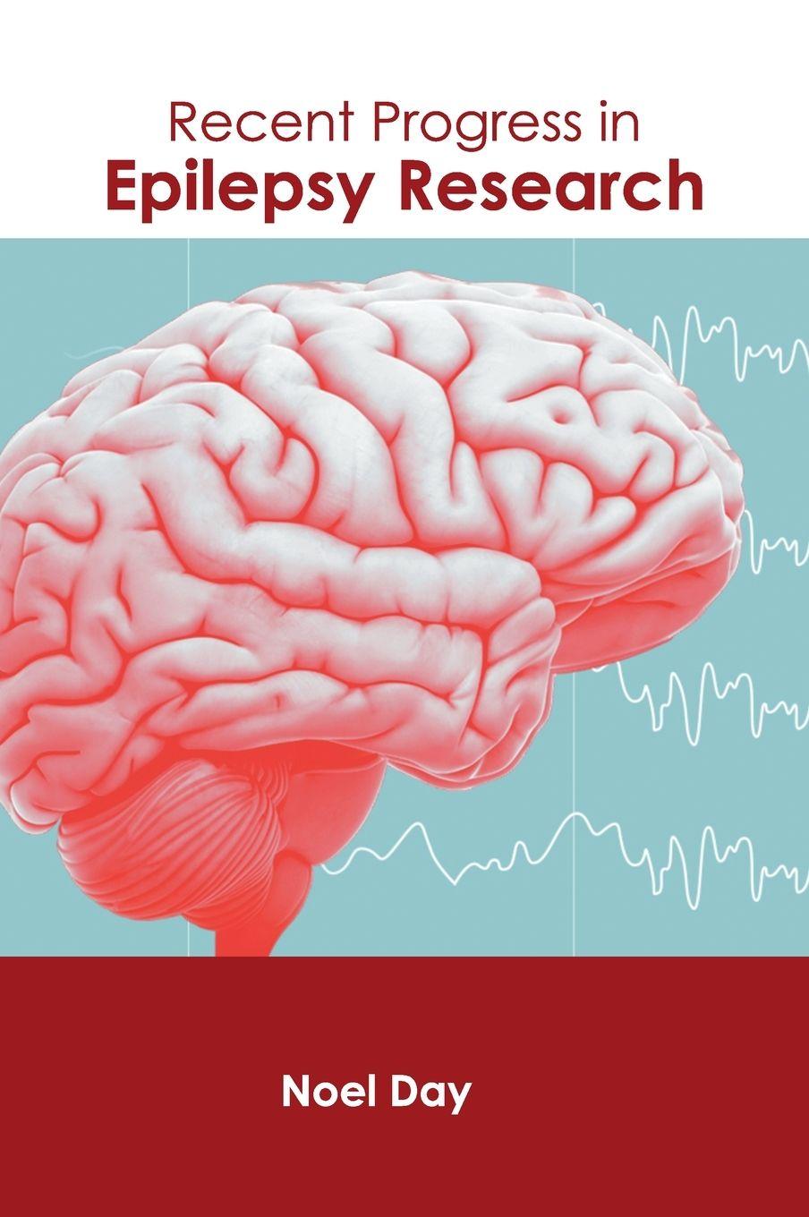 Vorderes Coverbild Recent Progress in Epilepsy Research