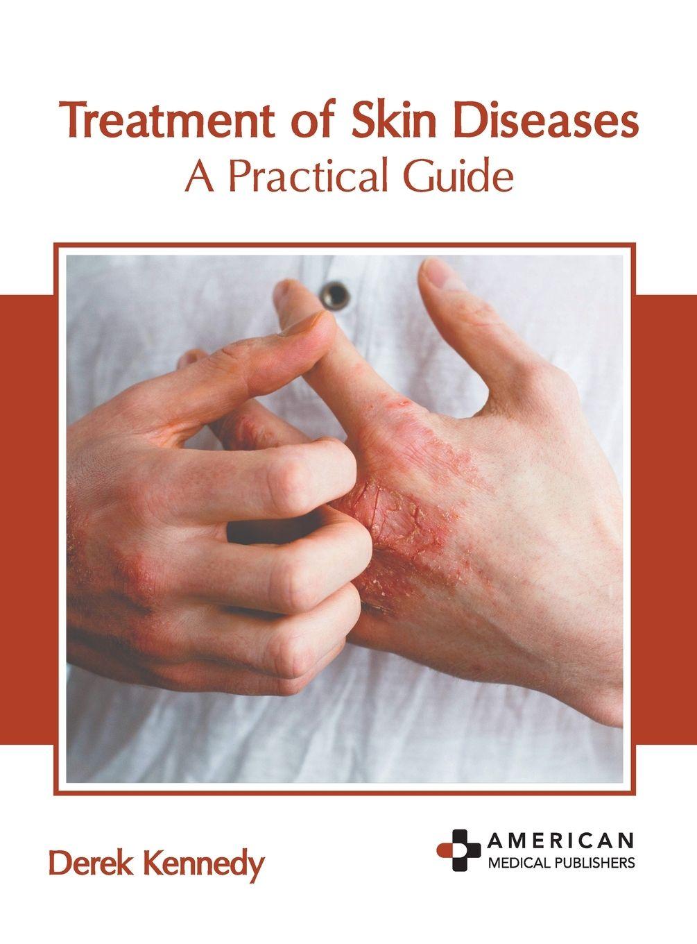 Vorderes Coverbild Treatment of Skin Diseases: A Practical Guide