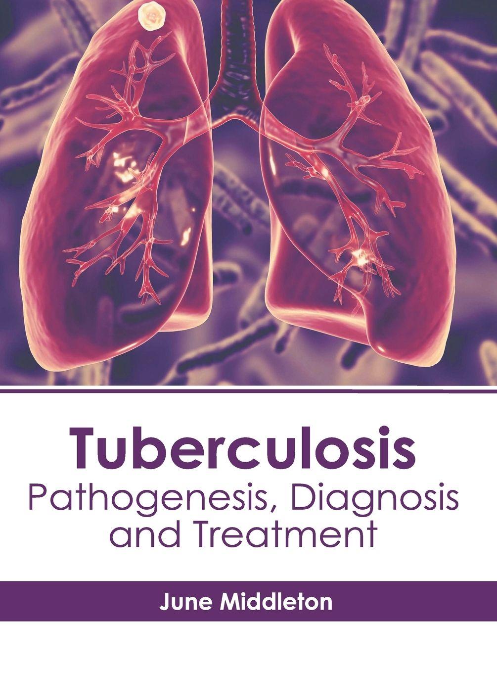 Vorderes Coverbild Tuberculosis: Pathogenesis, Diagnosis and Treatment