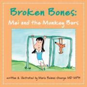 Vorderes Coverbild Broken Bones