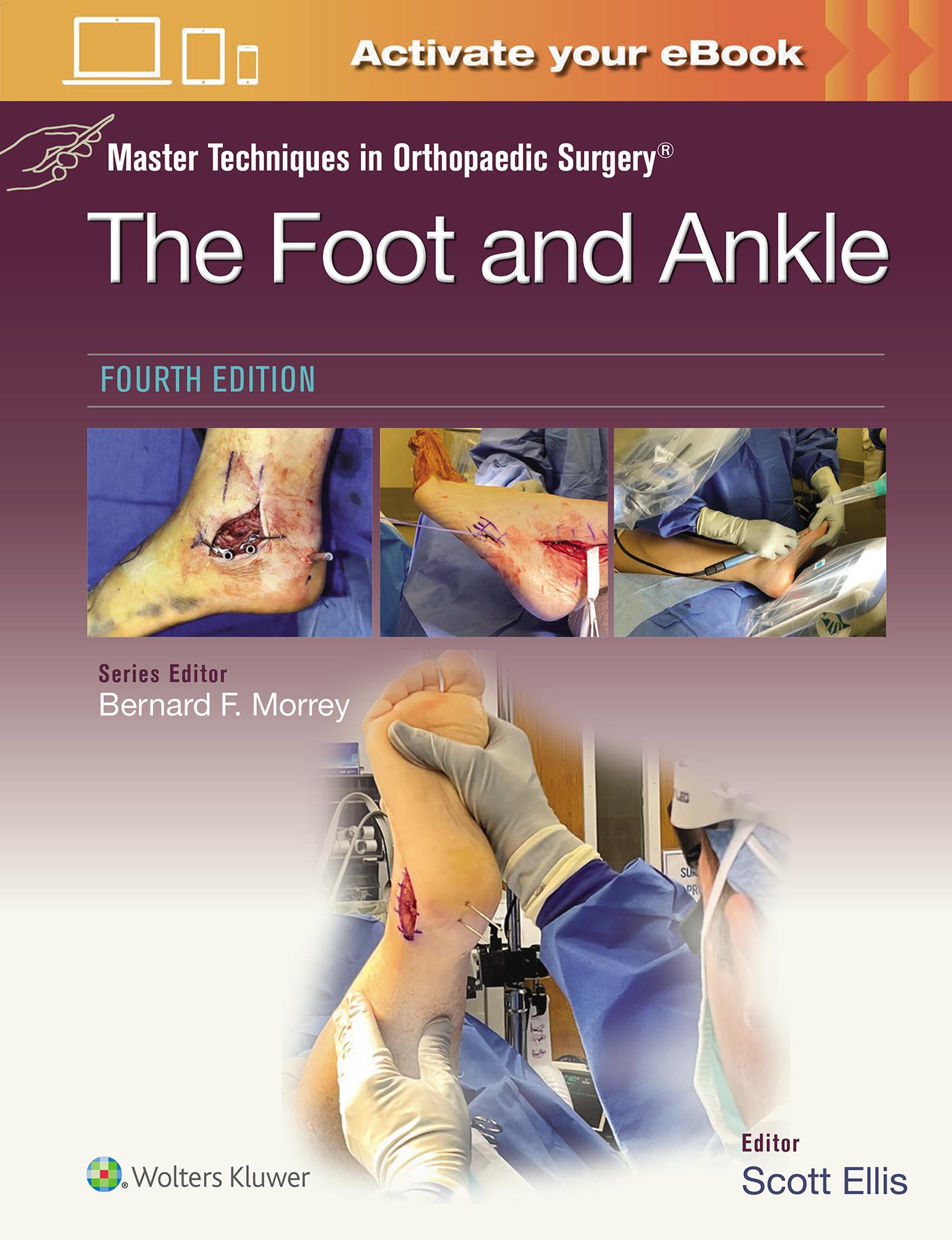 Vorderes Coverbild Master Techniques in Orthopaedic Surgery: The Foot and Ankle: Print + eBook with Multimedia