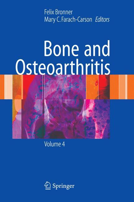 Vorderes Coverbild Bone and Osteoarthritis