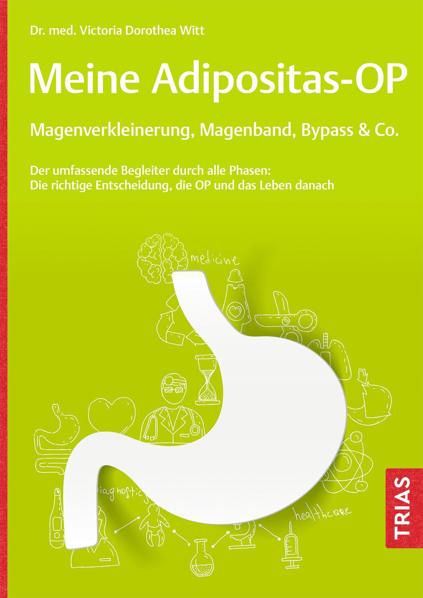 Vorderes Coverbild Meine Adipositas-OP. Magenverkleinerung, Magenband, Bypass & Co.