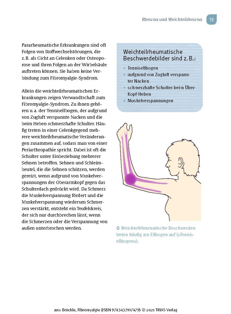 Beispielinhalt (Bild) Fibromyalgie