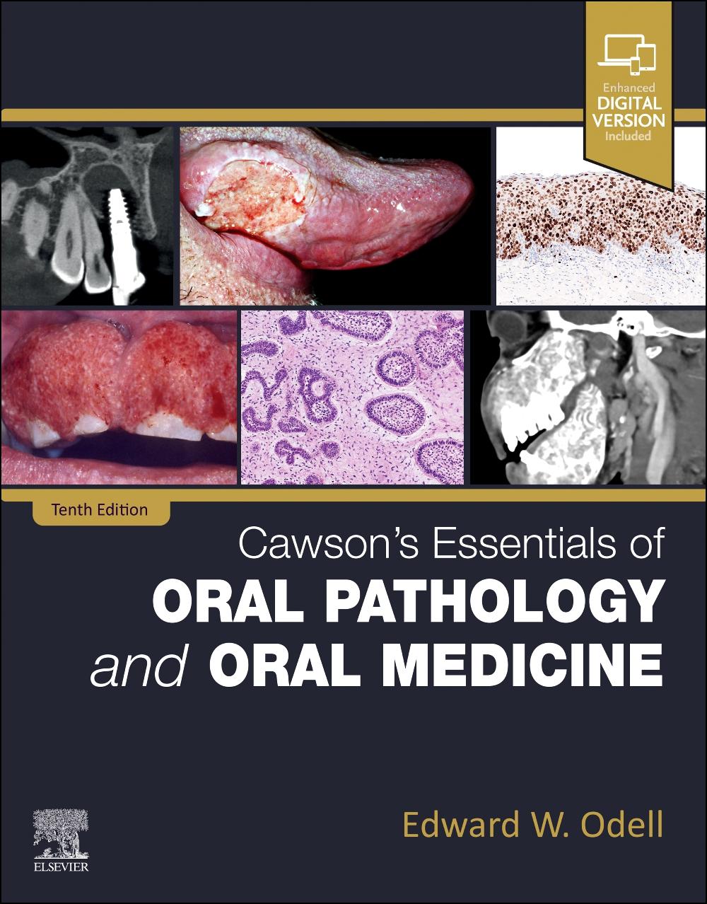 Vorderes Coverbild Cawson's Essentials of Oral Pathology and Oral Medicine
