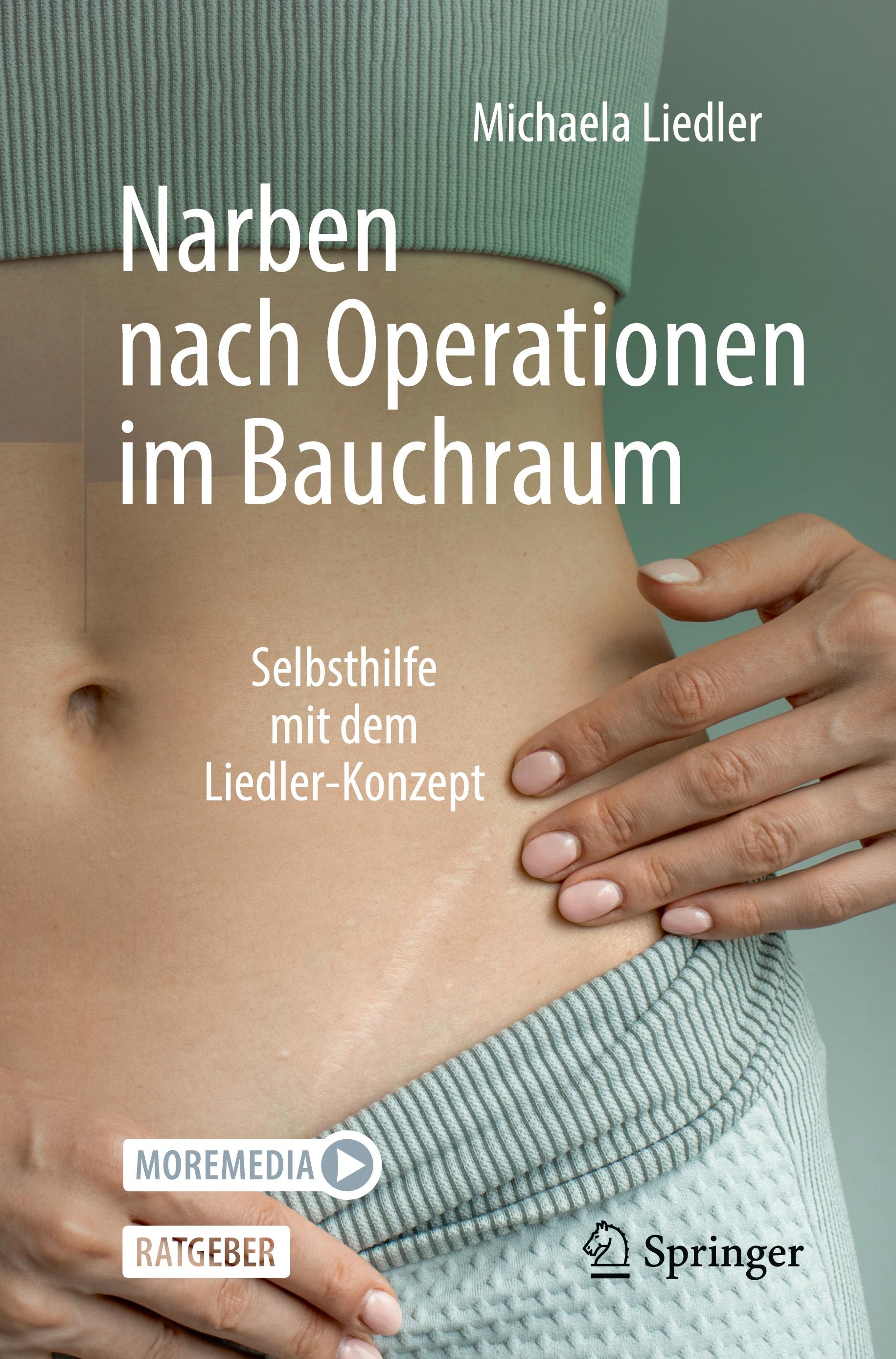 Vorderes Coverbild Narben nach Operationen im Bauchraum