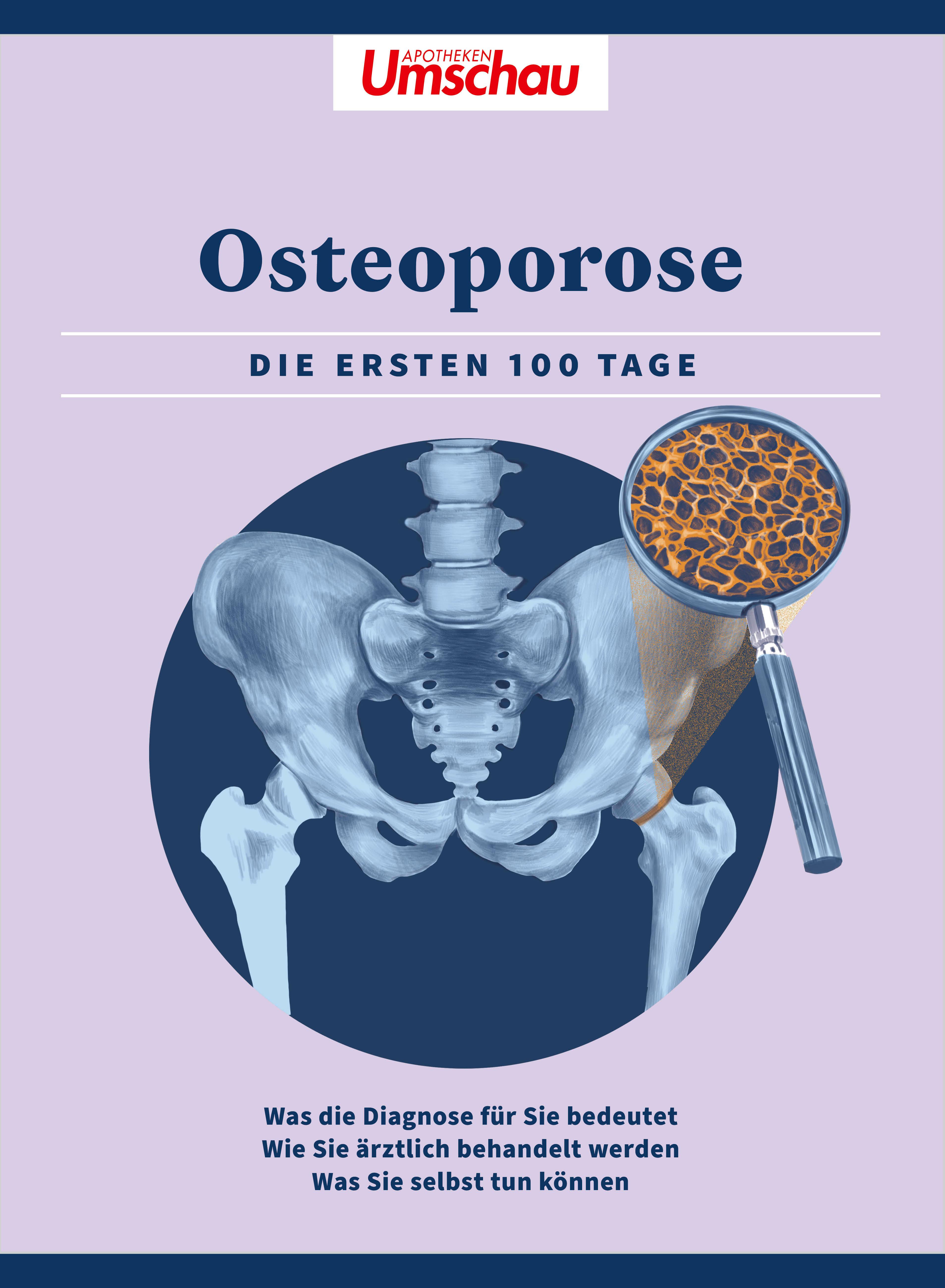Vorderes Coverbild Apotheken Umschau: Osteoporose