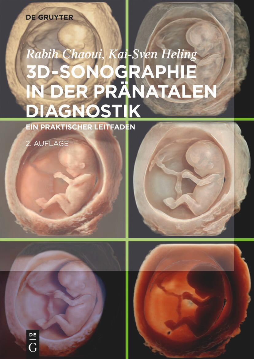Vorderes Coverbild 3D-Sonographie in der pränatalen Diagnostik