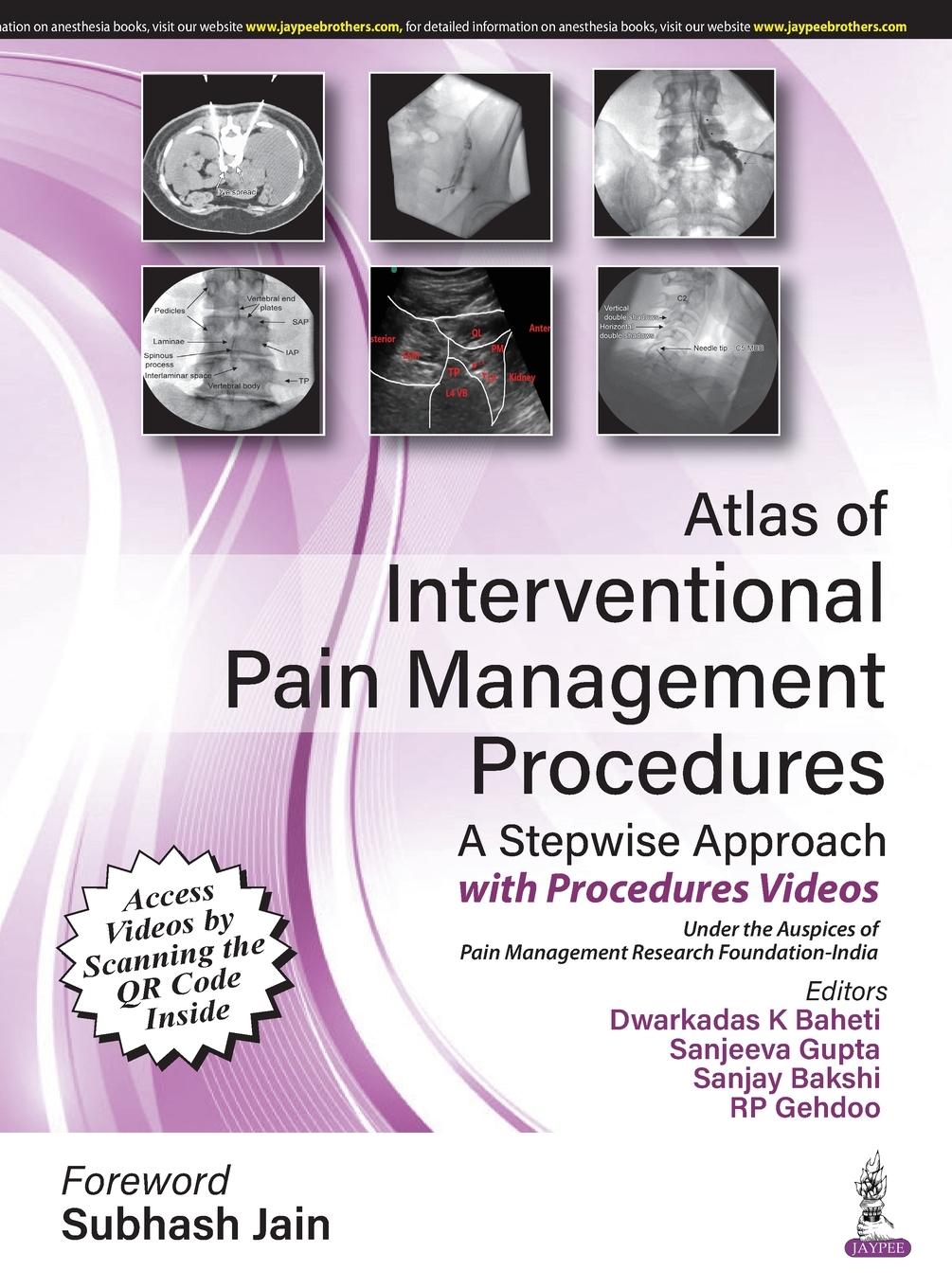 Vorderes Coverbild Atlas of Interventional Pain Management Procedures