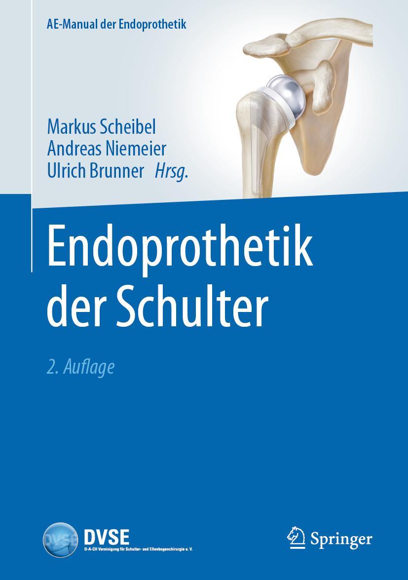 Vorderes Coverbild Endoprothetik der Schulter