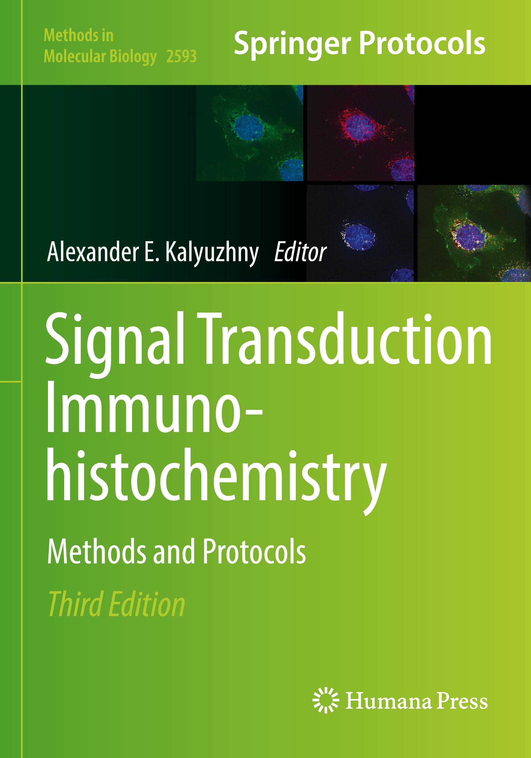 Vorderes Coverbild Signal Transduction Immunohistochemistry