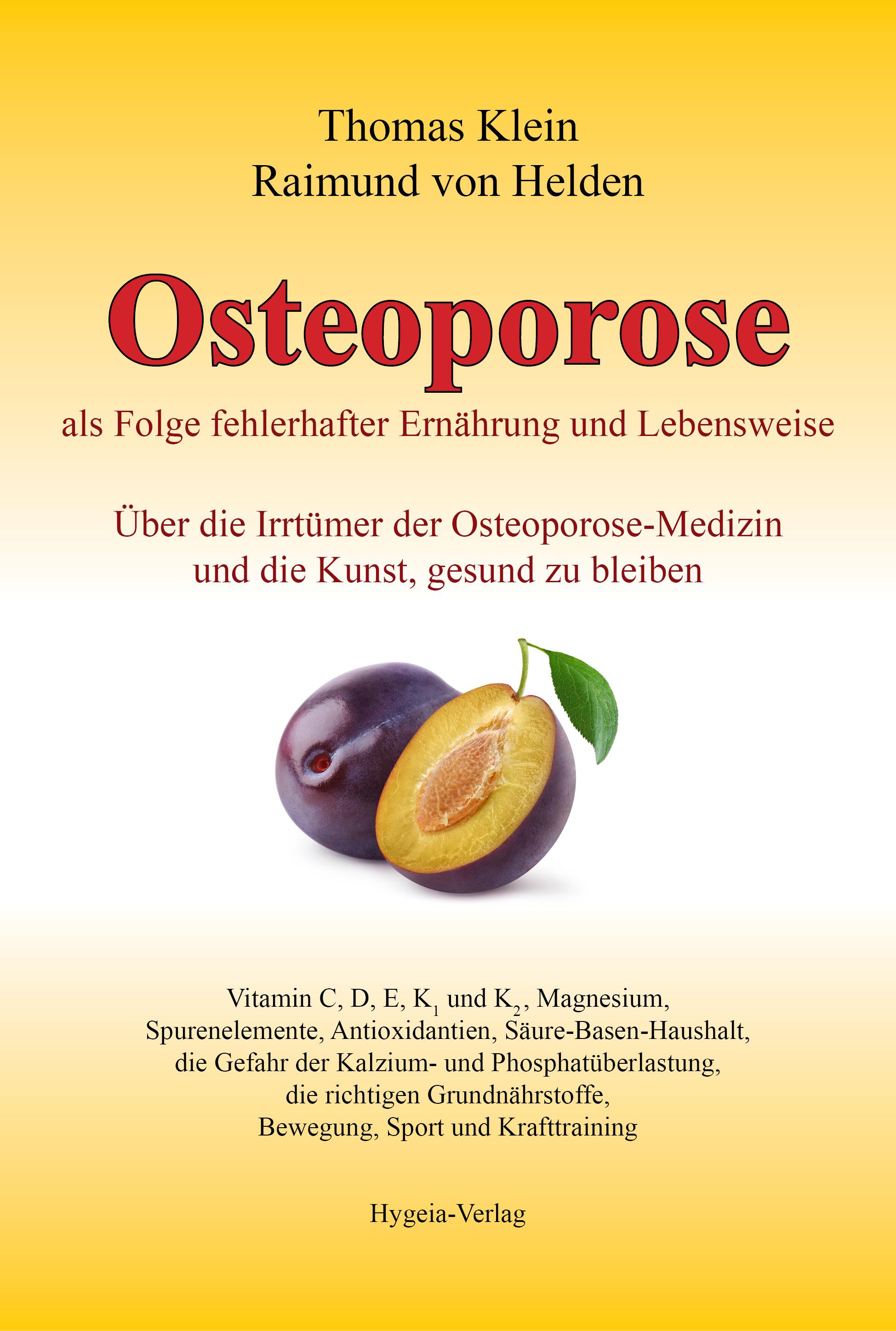 Vorderes Coverbild Osteoporose